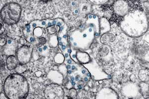 Influenza Activity Rises Worldwide as A(H3N2) Becomes Dominant